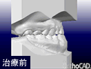 予測CAD
